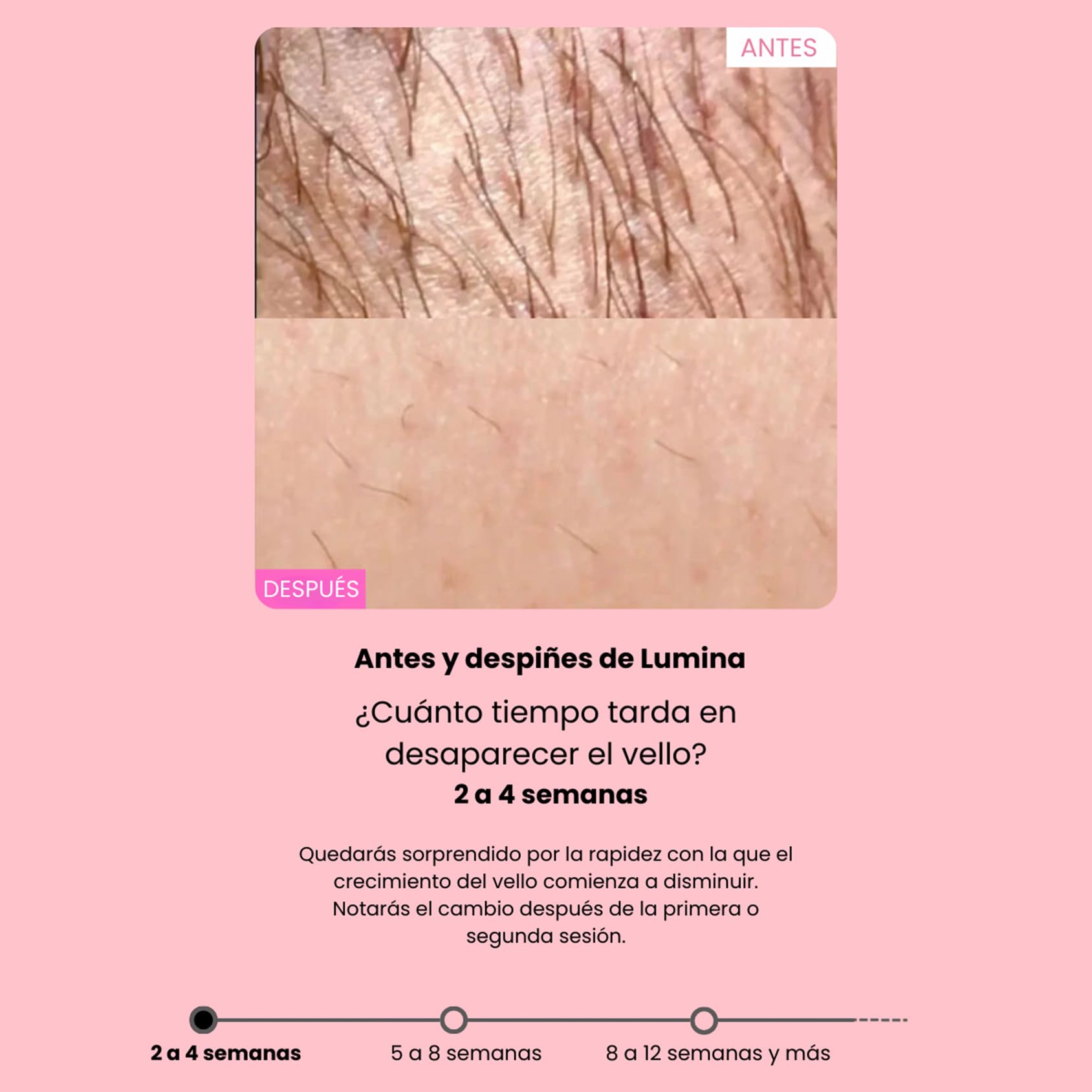Depiladora, Tecnología IPL, Detiene el Crecimiento del Vello, Proporcionando una Piel Suave con una Sensación Delicada e Indolora(Lila Claro)