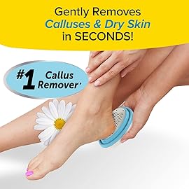 PedEgg Classic Foot File and Callus Remover - Safely & Painlessly Remove Tough Calluses, Dead Dry Skin for Smooth Soft Feet - As Seen On TV, 135 Precision Micro-Blades, Traps Shavings