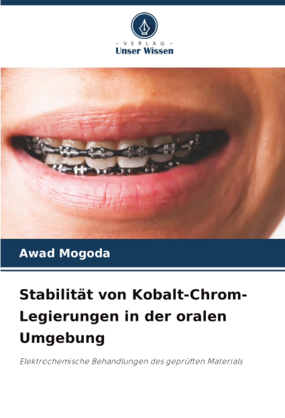 Stabilität von Kobalt-Chrom-Legierungen in der oralen Umgebung: Elektrochemische Behandlungen des geprüften Materials