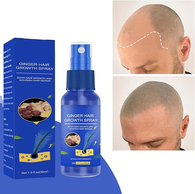 Hair Growth Serum,Hair Growth Spray and Enhancer,Thickening Hair Spray & Scalp Hair Care,Repairs Hair Follicles Hair Serums for Hair Growth,Anti Hair Loss Hair Regrowth Treatment for Women & Men,30ML