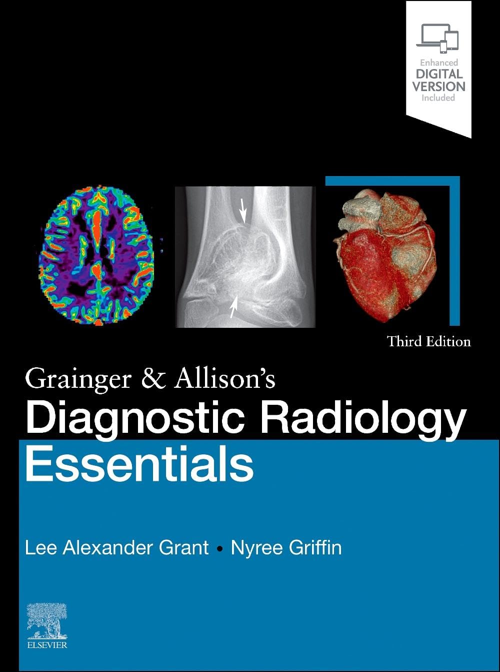 Buy Grainger & Allison's Diagnostic Radiology Essentials: Expert