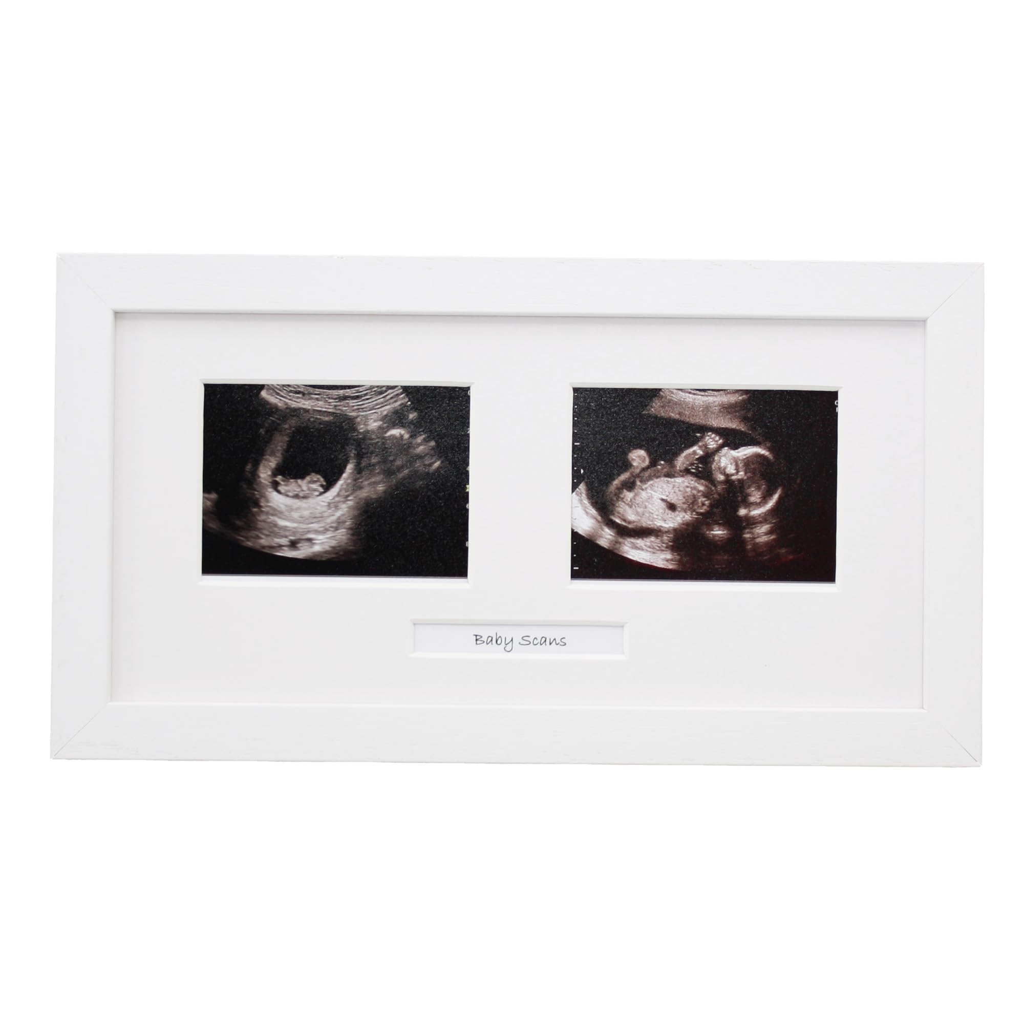Baby Scan Photo Frame. Optional Personalisation. Multi Aperture Frame to display Two Ultra sound photographs. Pregnancy announcment | Baby Shower | Pregnancy Keepsake (White Frame)