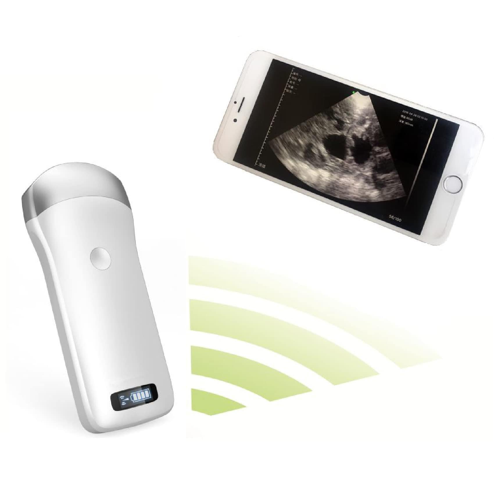 Scanner Portatile Wireless a ultrasuoni, sonda per Strumenti diagnostici di Gravidanza veterinaria, Smartphone compatibili, Tablet, per suini e Ovini