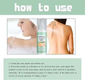 Acne Treatment Spray for Back & Body - 120ml