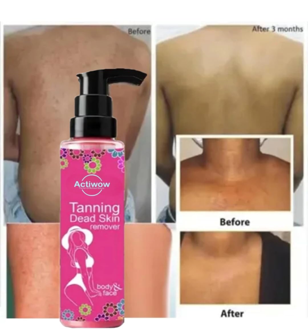 Actiwow Beauty Tanning Dead Skin Remover For Face and Body | Tan Skin Remover For Women (100Ml) 1