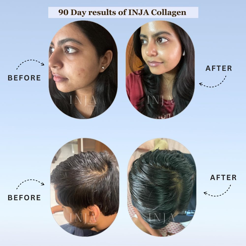 Inja Wellness Beauty Marine Collagen Supplement For Women, M...