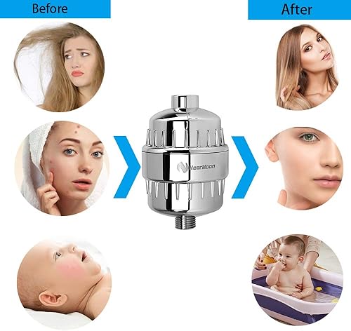 Miniatura 4 de NearMoon Filtro de ducha de 15 etapas de alto rendimiento, suavizante de cabezal de ducha filtrado para agua dura, reduce la picazón en la piel