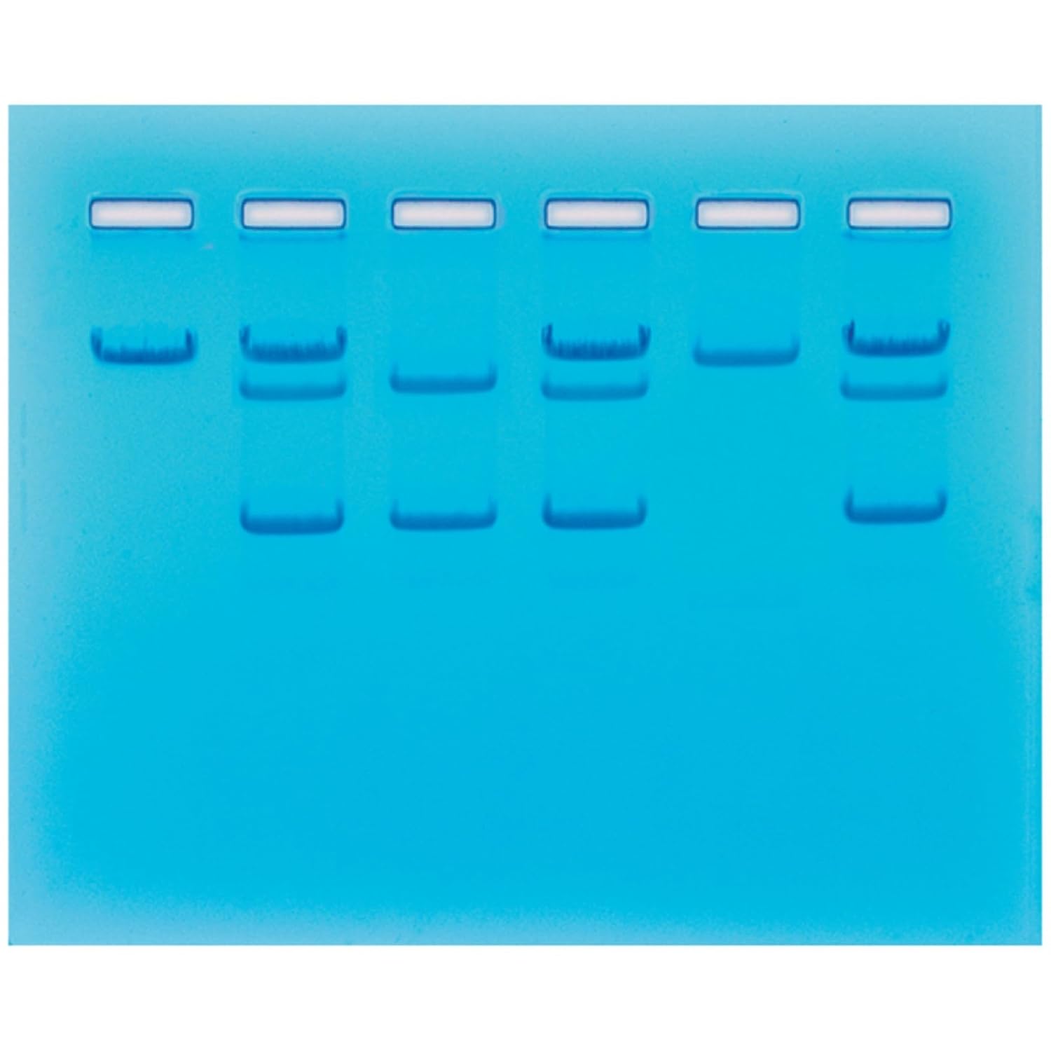 Sickle Cell Gene Detection (DNA-Based) Group Size for 8 Gels