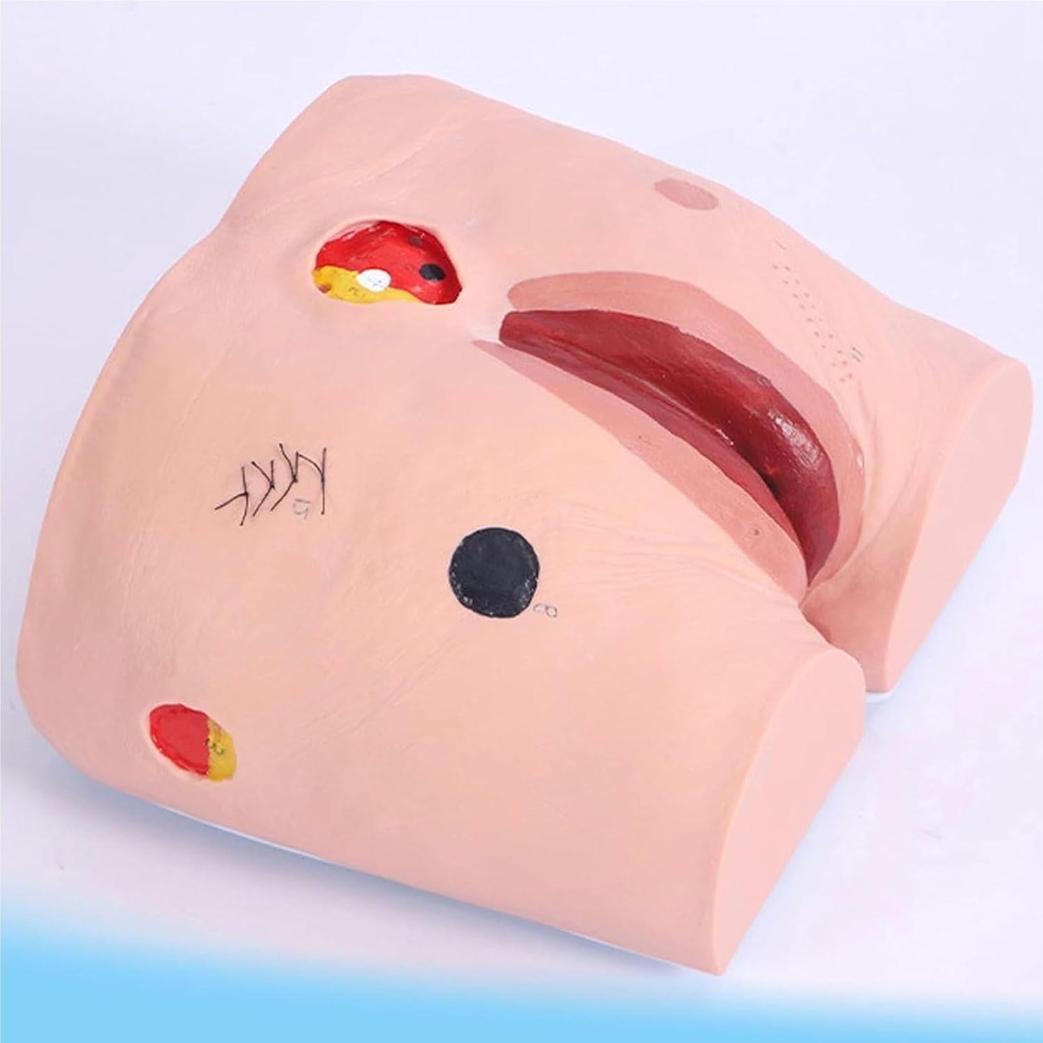 消化器外科 2011年5月号 アトラスで学ぶ達人の手術 臨時増刊号 m3電子