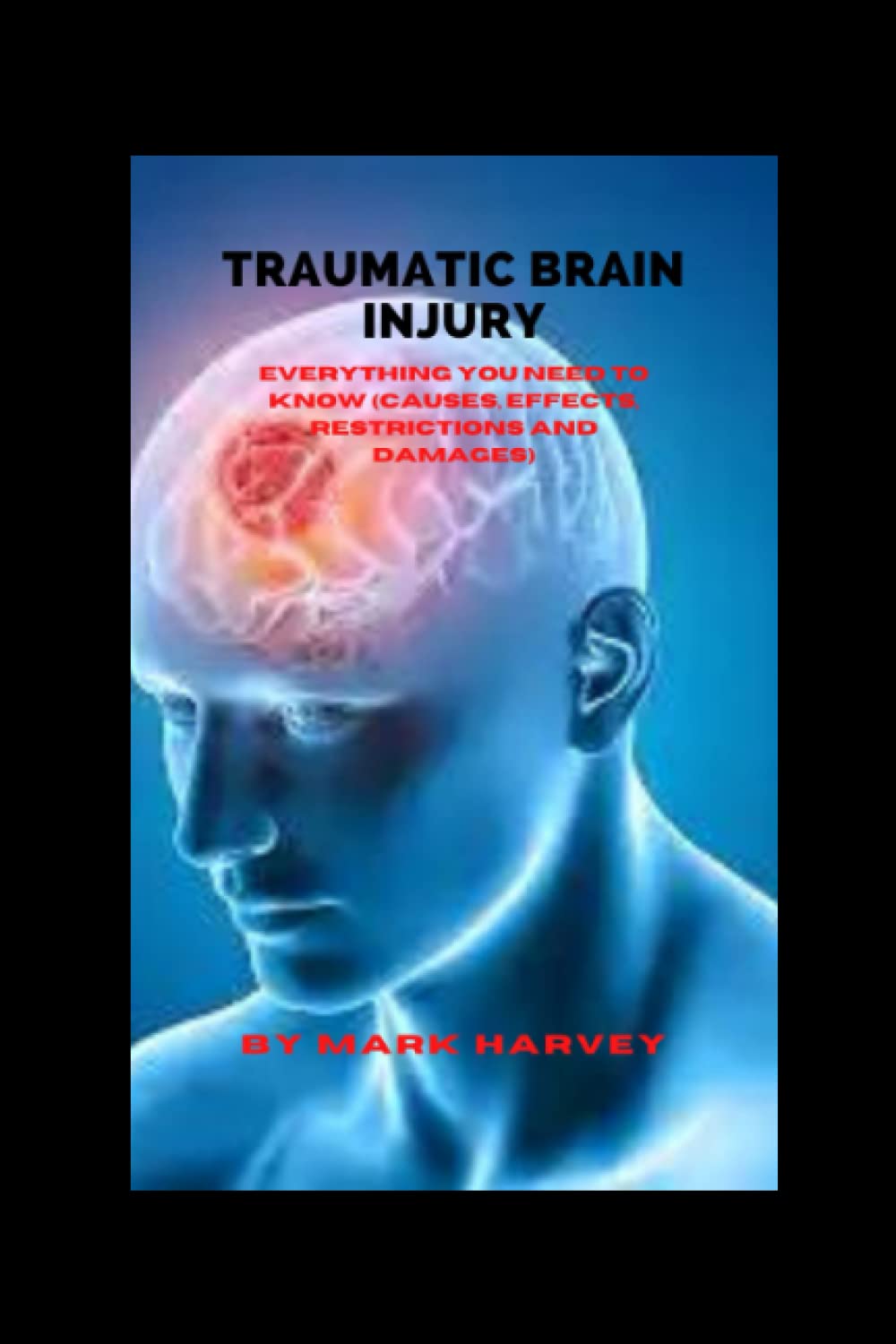 TRAUMATIC BRAIN INJURY: Everything You Need To Know (Causes, Effects, Restrictions And Damages)