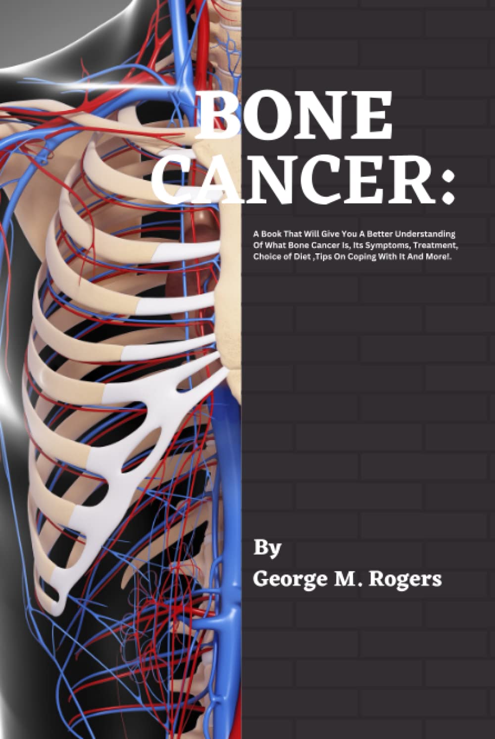 BONE CANCER: A Book That Will Give You A Better Understanding Of What Bone Cancer Is, Its Symptoms, Treatment, Choice of Diet ,Tips On Coping With It And More!. (Striving With Cancer)