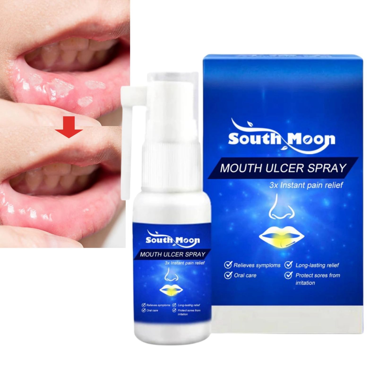 Mouth Ulcer Treatment Spray,Oral Ulcer Sprays,Ulcer Breath Sprays,Canker Relief Spray,Canker Sore Treatment,Mouth Ulcer Spray,Mouth Freshener Spray,Breath Spray for Bad Breath,Dry Mouth Oral Spray