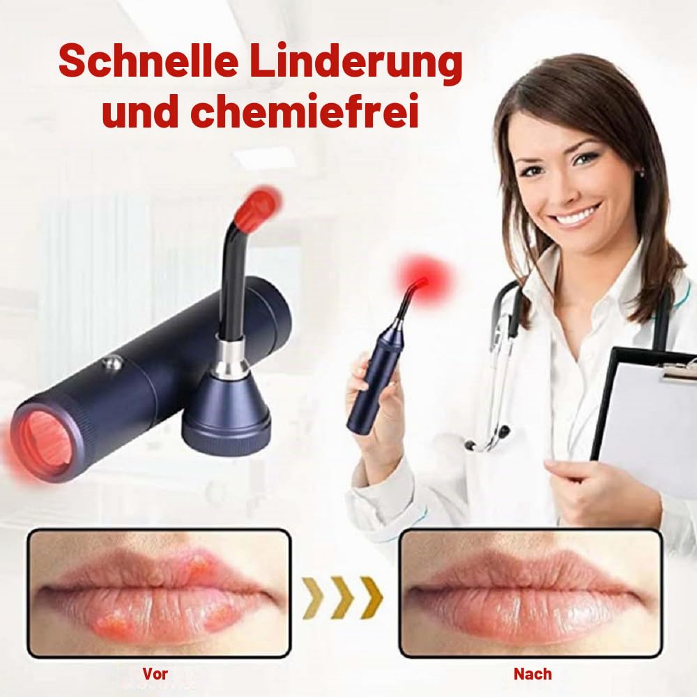 Rotlichttherapie Gerät – 3-in-1 Rotlicht, wiederaufladbar für Mundgeschwüre, Lippen & empfindliche Bereiche