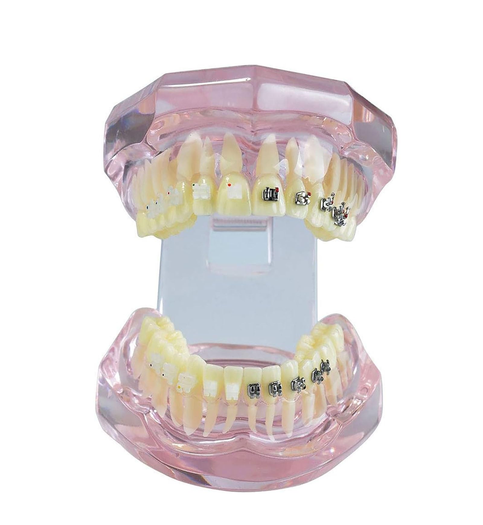 Modello di Dente, Apparecchio Dentale in Metallo E Ceramica Denti Modello, Modello Ortodontico per Adulti Dentale Denti Modello Dentista per Insegnamento di Scienze Studio Odontoiatria Strumenti per (