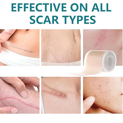 Miniatura 7 de Hojas de silicona para cicatrices de 1.57 x 59 pulgadas, cinta de silicona extra larga, tiras de silicona para cicatrices, suministros de vendaje de