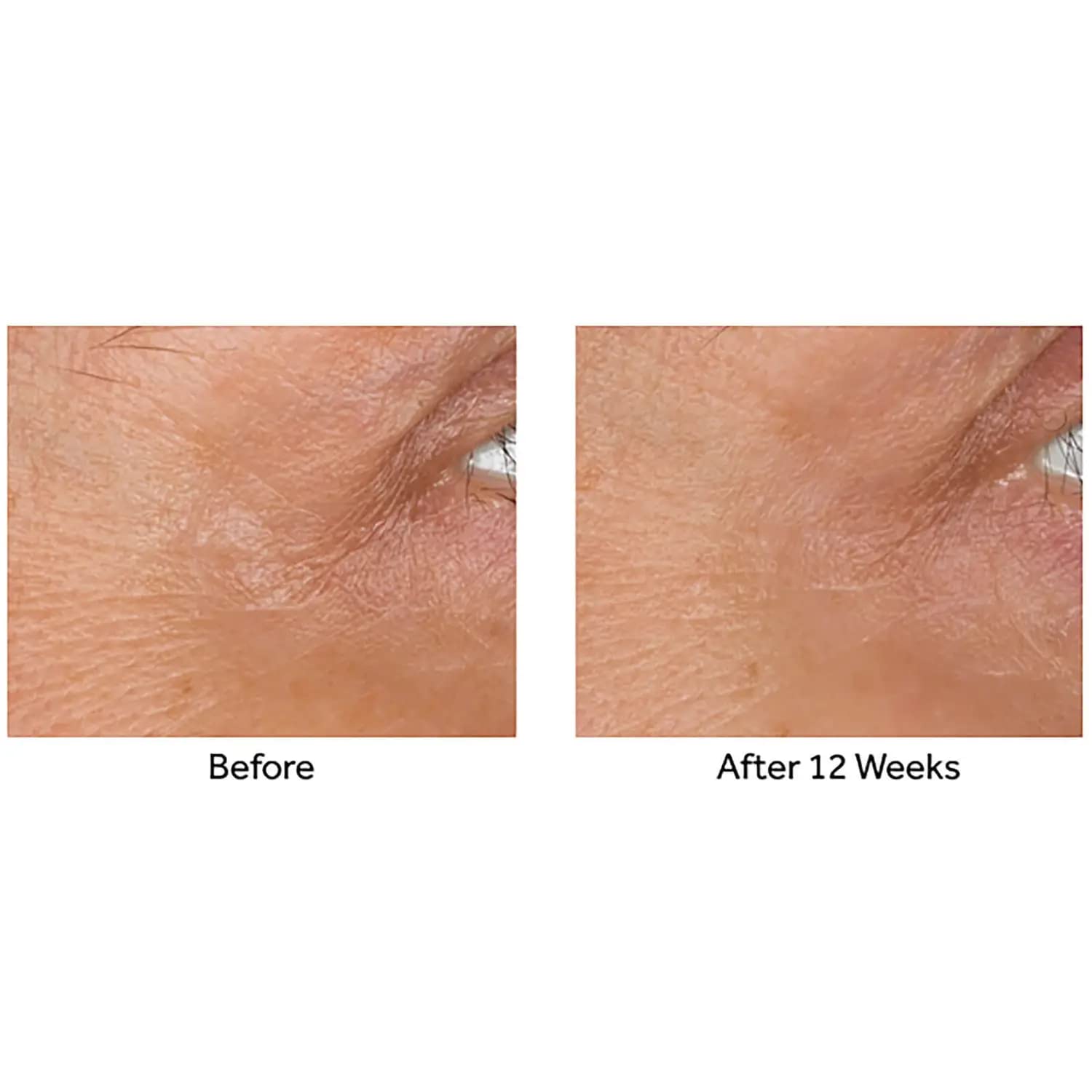 No7 Laboratories Line Correcting Booster Serum - Potent Collagen Peptide Serum for Fine Lines and Wrinkles - Moisturizing Formula for All Aging Skin Types (15 ml)