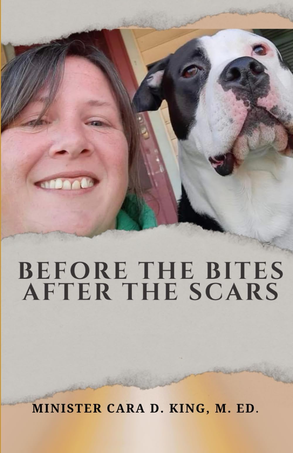 BEFORE THE BITES, AFTER THE SCARS: A Story of Survival, Sobriety, and Spiritual Awakening