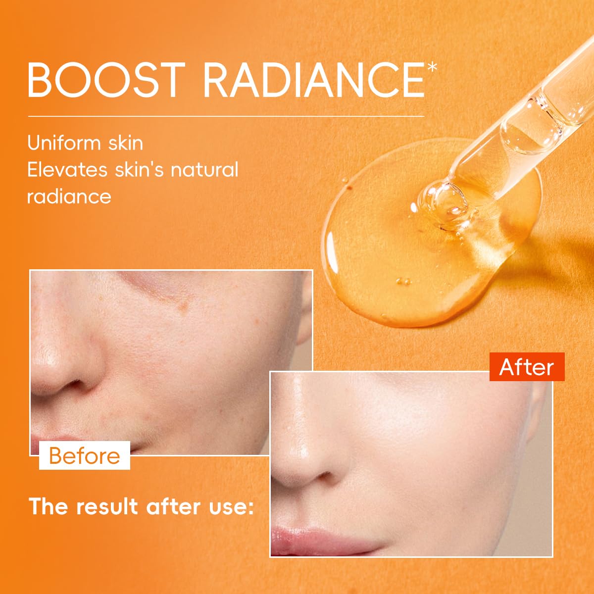 Vitamin C Serum for Face 2-Pack, Brightening Facial Serum with Hyaluronic Acid & Vitamin E, Helps Improve Dark Spots, Uneven Tone, Fine Lines & Wrinkles, 1 Fl Oz Each - Image 7