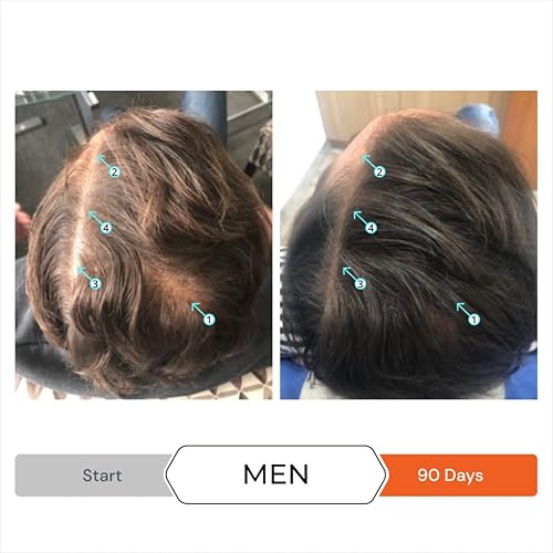 Miniatura 4 de DS Laboratories Revita - Juego de champú y acondicionador, champú y acondicionador para engrosar el cabello para apoyar el crecimiento del cabello,