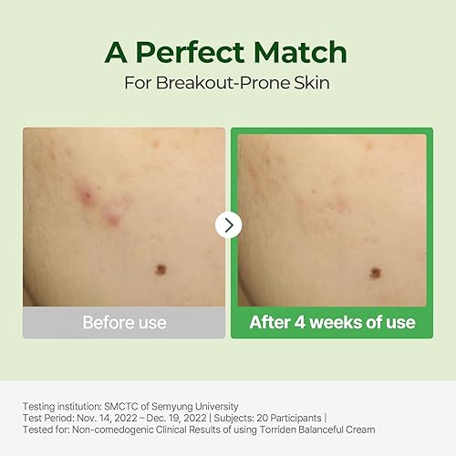 Miniatura 3 de Torriden Crema de cica equilibrada, hidratante calmante y nutritiva que hidrata, hidrata y calma con 5 diferentes extractos de centella asiática