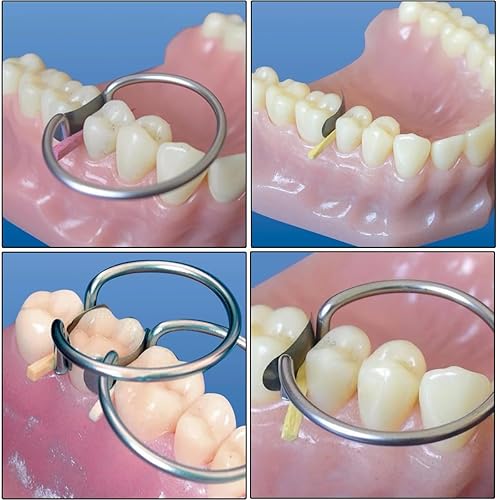 Miniatura 5 de Bandas de matriz dental, 100 unidades, sistema de matrices metálicas contorneadas seccionales de 50 m+2 anillos Delta para recambio interproximal de