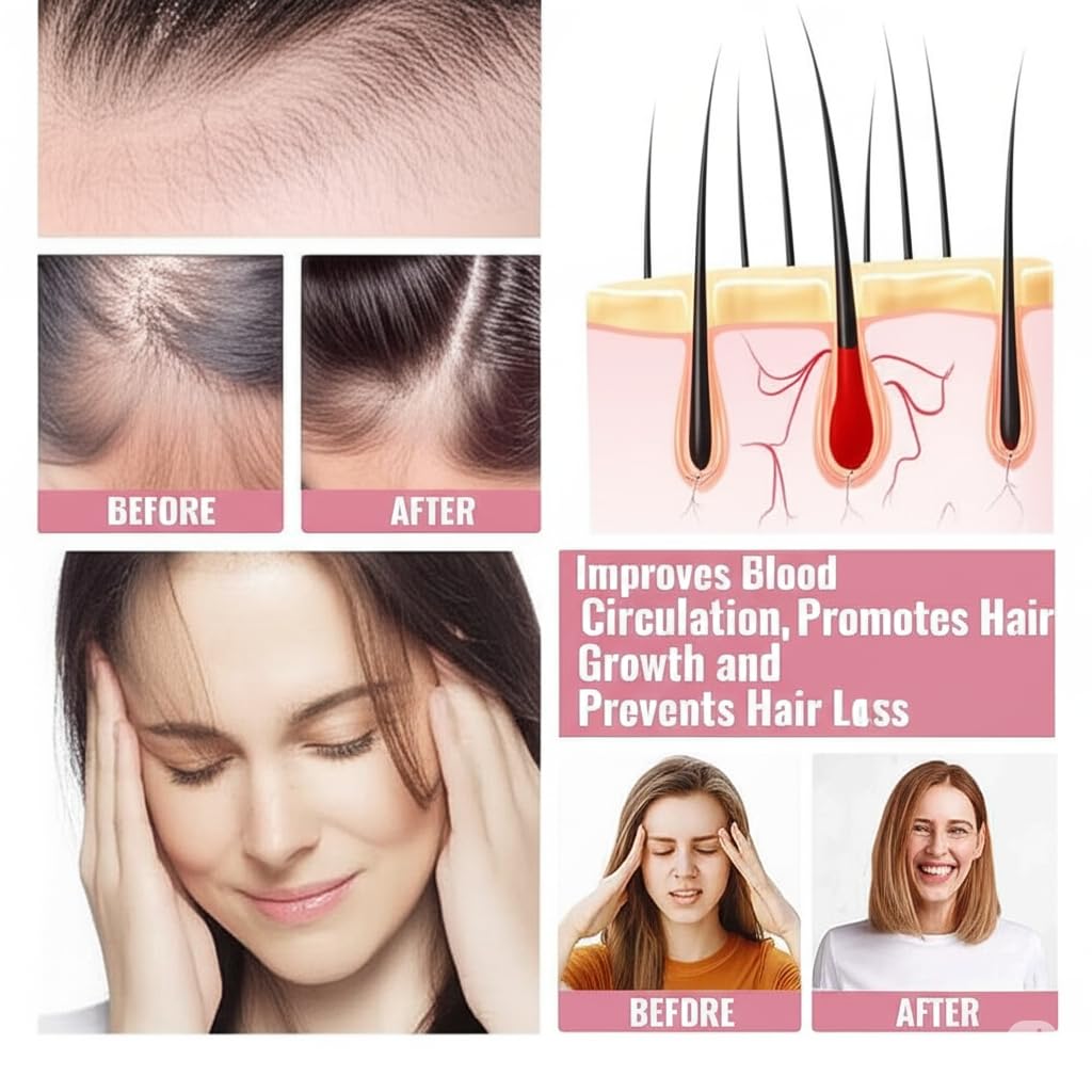 Buy Now Episkey Scalp Massager Shampoo Brush, Eco-Friendly Wheat