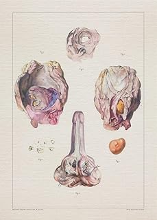 Anatomy UROLITHIASIS PROSTATE BLADDER print SRA3 12x18 conqueror laid paper