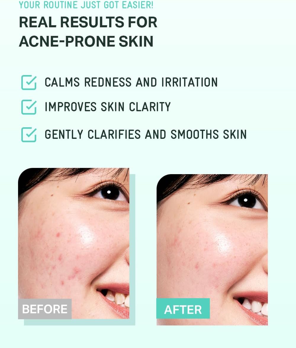 BRING GREEN Tea Tree CICA Soothing Toner | Mild Daily Skincare Routine for Cooling and Hydrating Effect (8.5 Fl. Oz., 250ml) - Image 6