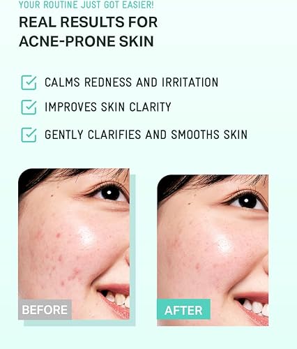 Miniatura 6 de BRING GREEN Tea Tree CICA Tónico calmante | Rutina diaria suave de cuidado de la piel para efecto refrescante e hidratante (8.5 onzas líquidas), 8.5