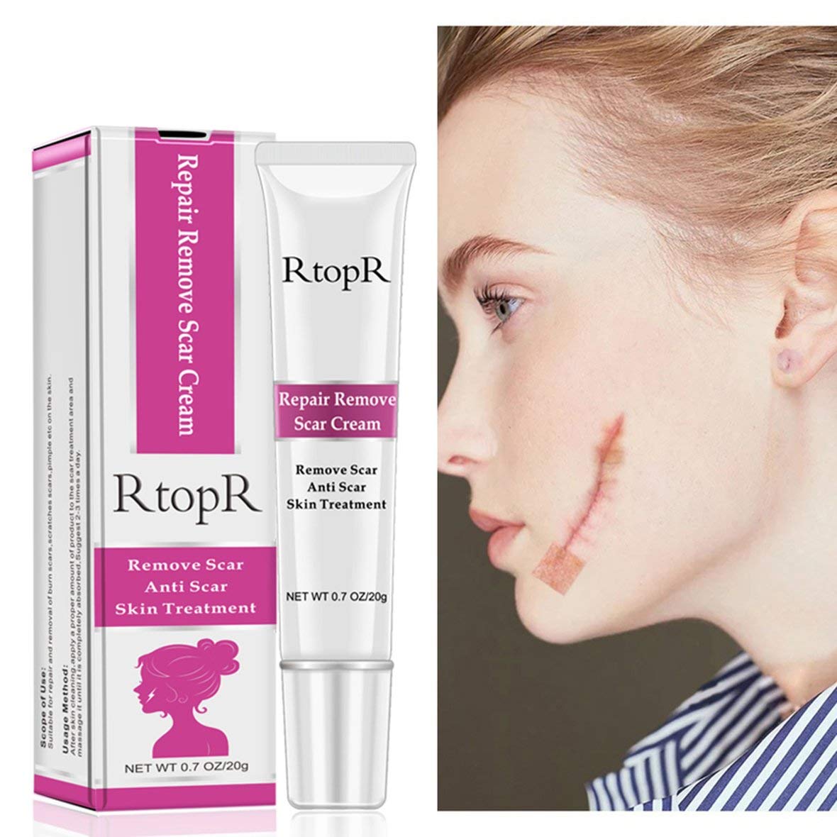 RtopR Acne Scar Removal Cream Fast Skin Tag Remover Remove Scar Cream