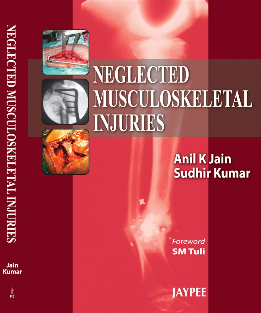 Neglected Musculoskeletal Injuries