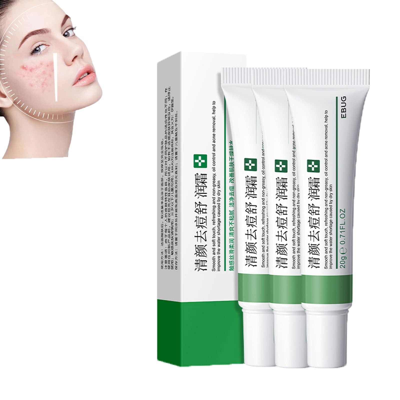 Whitening Freckle Cream,Acne Scar Removal Treatment Cream,Pigmentation Removal Cream For Face,Remove Melasma Acne Cream Fading Spot Cream,Dark Spot Corrector For Face (4PCS,Whitening Freckle)