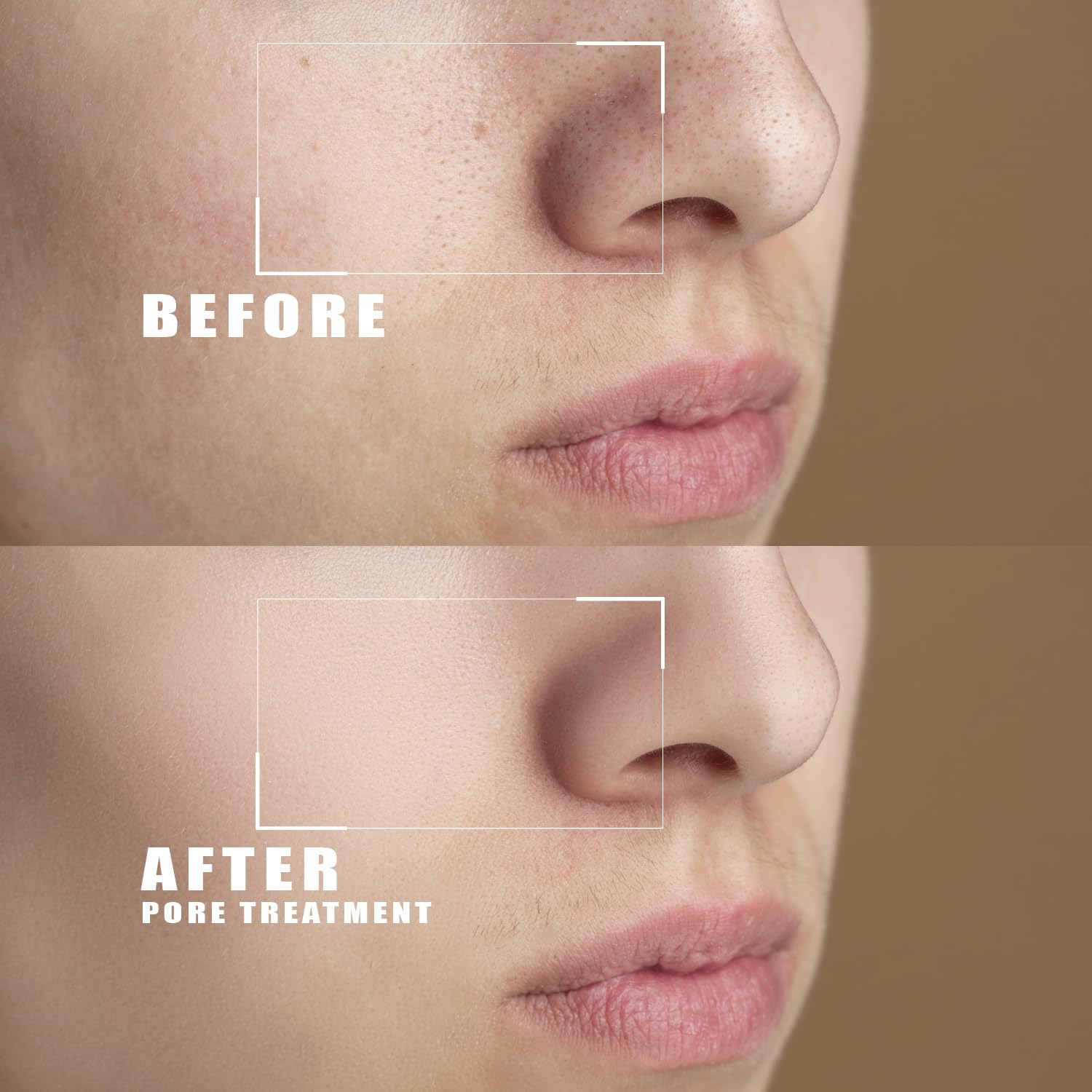 Body and Face Peeling Cream 200ml – Facial Peeling Cream for Deep Cleansing, Exfoliation and Skin Moisturization – for Face Dead Skin Removing, Pore-Unclogging & Skin-Smoothing - Image 7