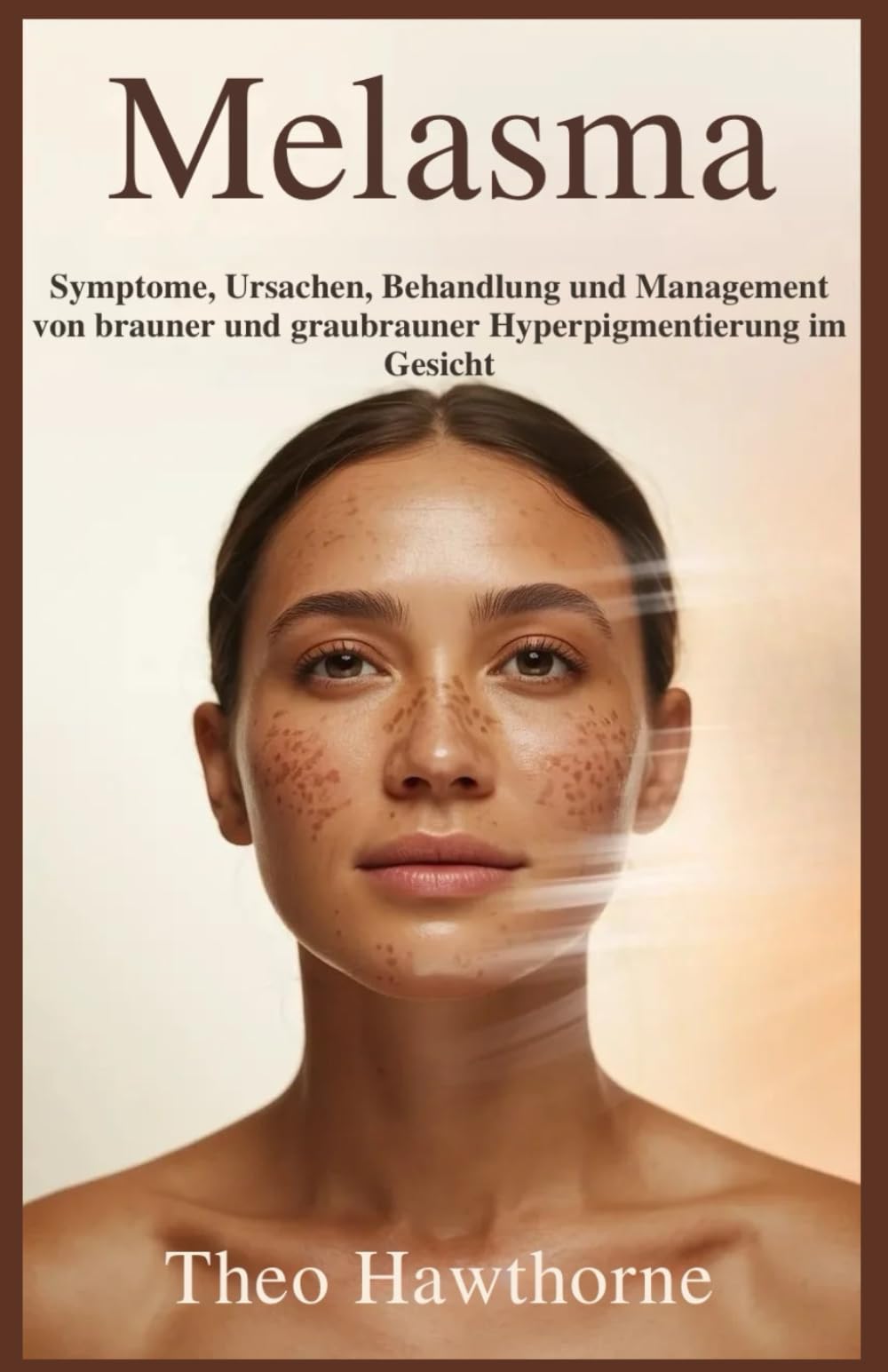 Melasma: Symptome, Ursachen, Behandlung und Management von brauner und graubrauner Hyperpigmentierung im Gesicht