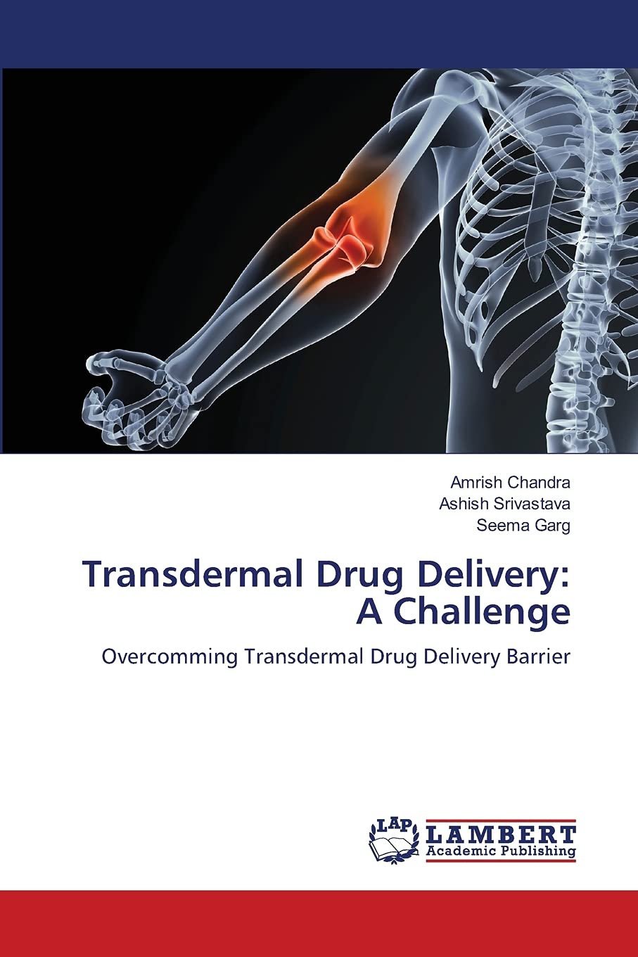 Transdermal Drug Delivery: A Challenge: Overcomming Transdermal Drug Delivery Barrier