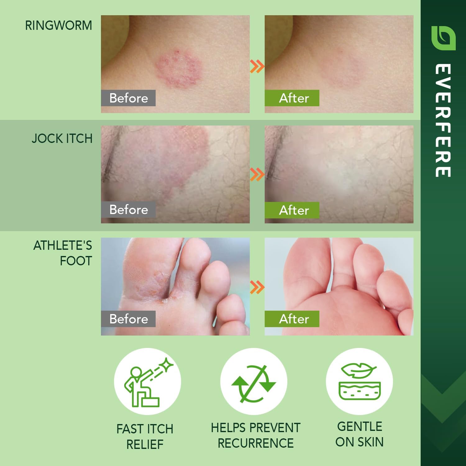 Antifungal Cream for Athletes Foot Treatment: Relief from Jock Itch Ringworm & Skin Fungus – Advanced Dual Antifungal Formula with Botanicals for Daily Anti-Itch Soothing Skin Care Adults & Kids 60g - Image 6