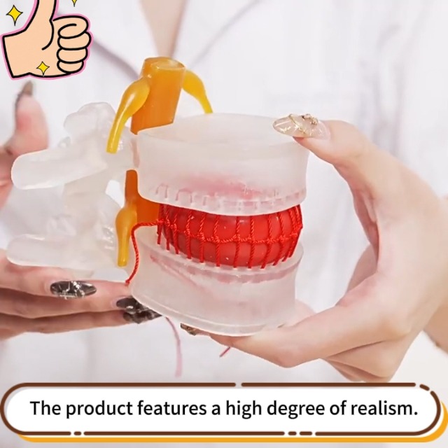 Image of Human Anatomical Lumbar Herniation Model with Nerve Root,Anatomical Vertebrae Model for Education,Excellent Way for Demonstrating Disc(Yellow)