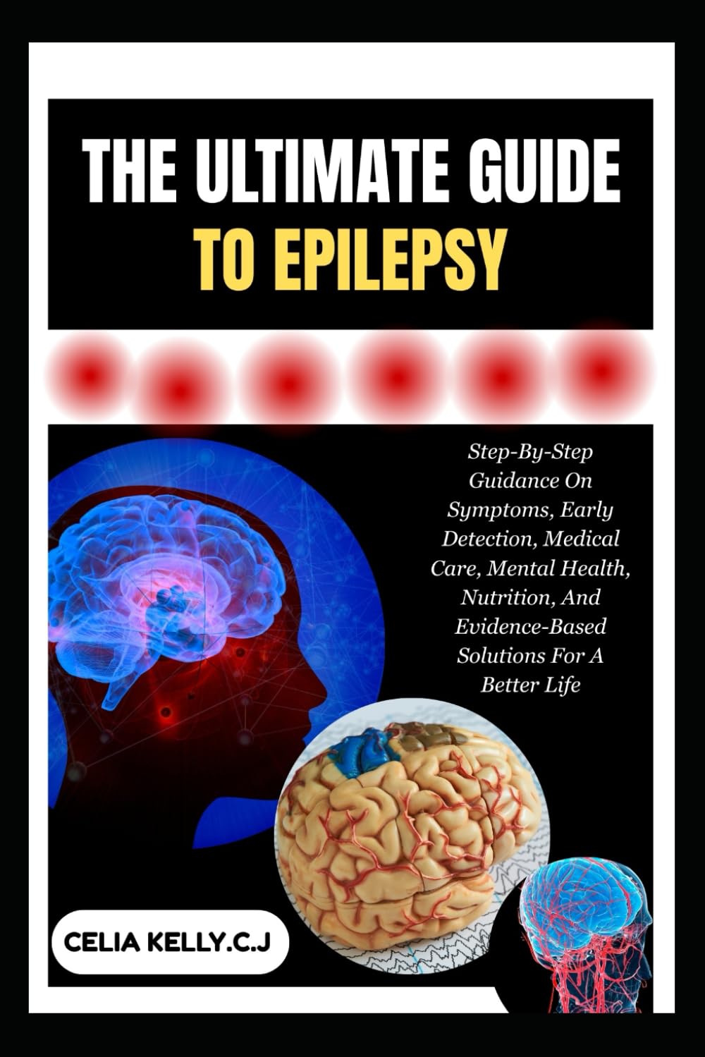 THE ULTIMATE GUIDE TO EPILEPSY: Step-By-Step Guidance On Symptoms, Early Detection, Medical Care, Mental Health, Nutrition, And Evidence-Based Solutions For A Better Life