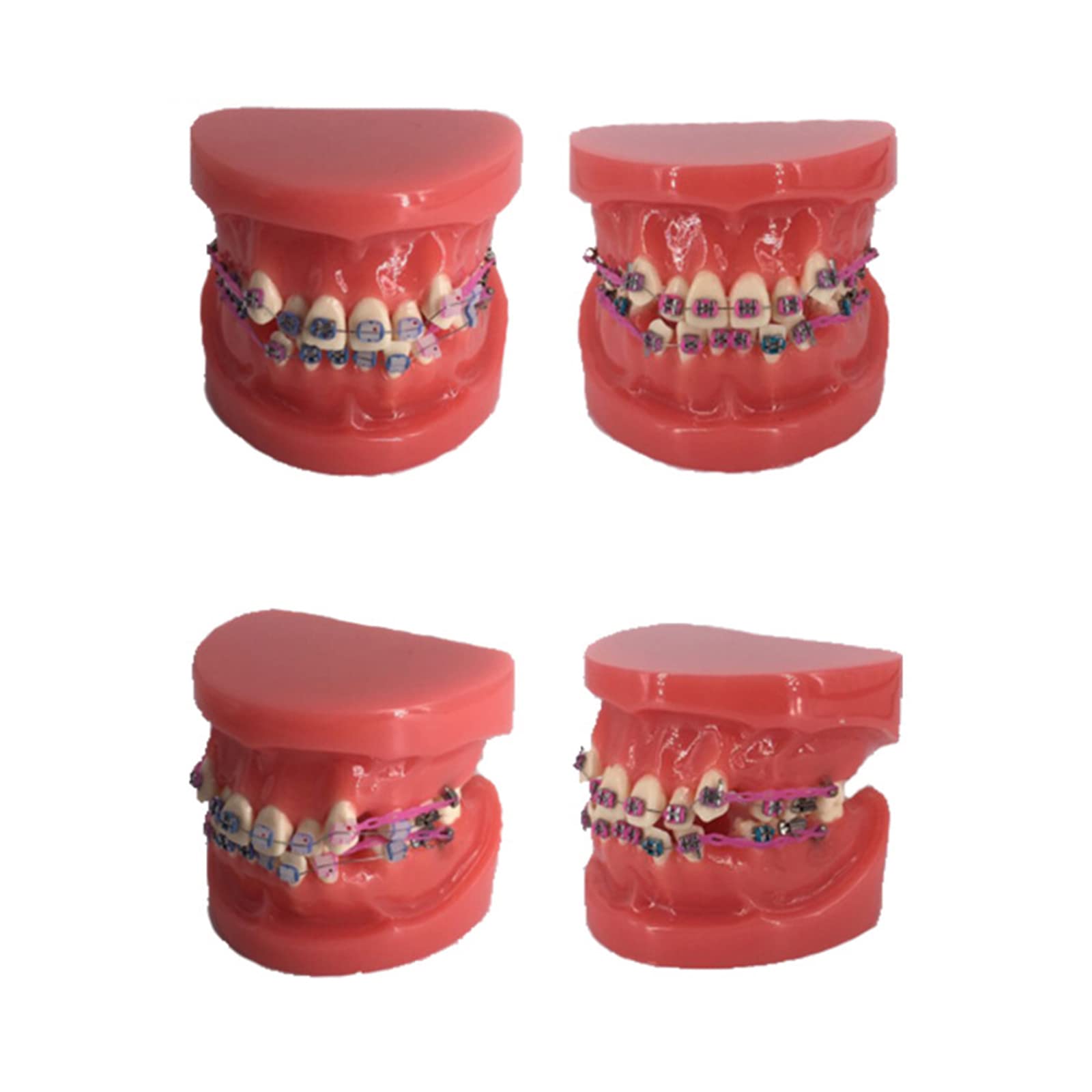 Modello di Denti, Forniture per Studio per L'insegnamento Dentale per Bambini Modello Dimostrativo di Denti Ortodontici Ortodontici Standard per Adulti per Bambini Studenti Dentista