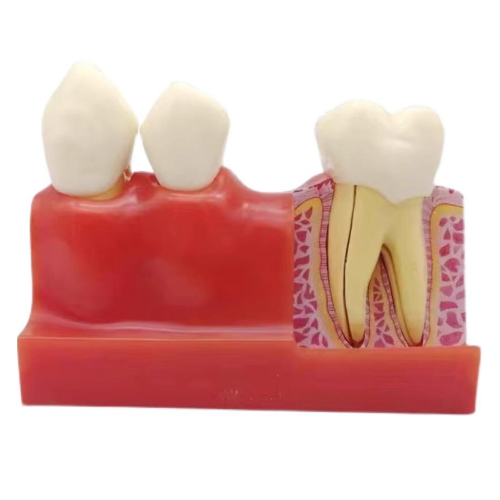 4-Faches Zahnimplantat-Modell – Zahnarztpraxis Implantat-Modell – Für Labor-Dental, Pädagogische Analyse