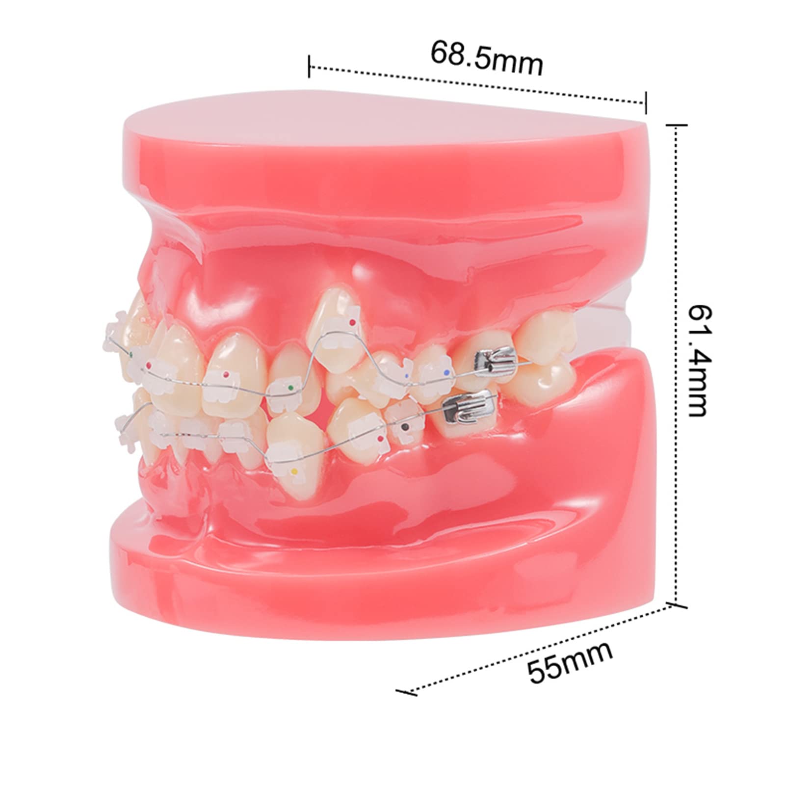 Model zębów dentystycznych-model demonstracyjny ortodoncji-dentystyczny z metalowymi wspornikami model zębów ortodontycznych do celów edukacyjnych nauka narzędzie dydaktyczne(A) (A)