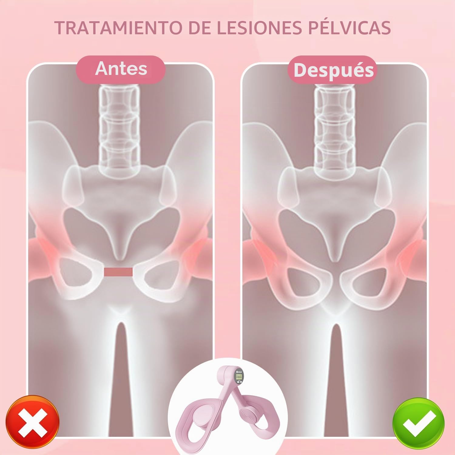 Entrenador de músculos del Suelo pélvico, Entrenador de Cadera, Entrenador de Muslos, recortador de Muslos, reparación de músculos del Suelo pélvico, para Caderas, piernas, Brazos (Rosa)