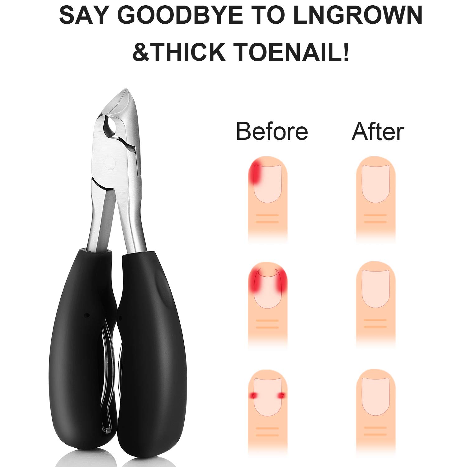 Mudder 2pack Ingrown Large Toenail Clippers for Thick Toenails , Pedicure Clippers Heavy Duty Easy Grip Rubber Handle Style Toenail Clipper Ingrown Toenail Tool for Men, Seniors, Adults