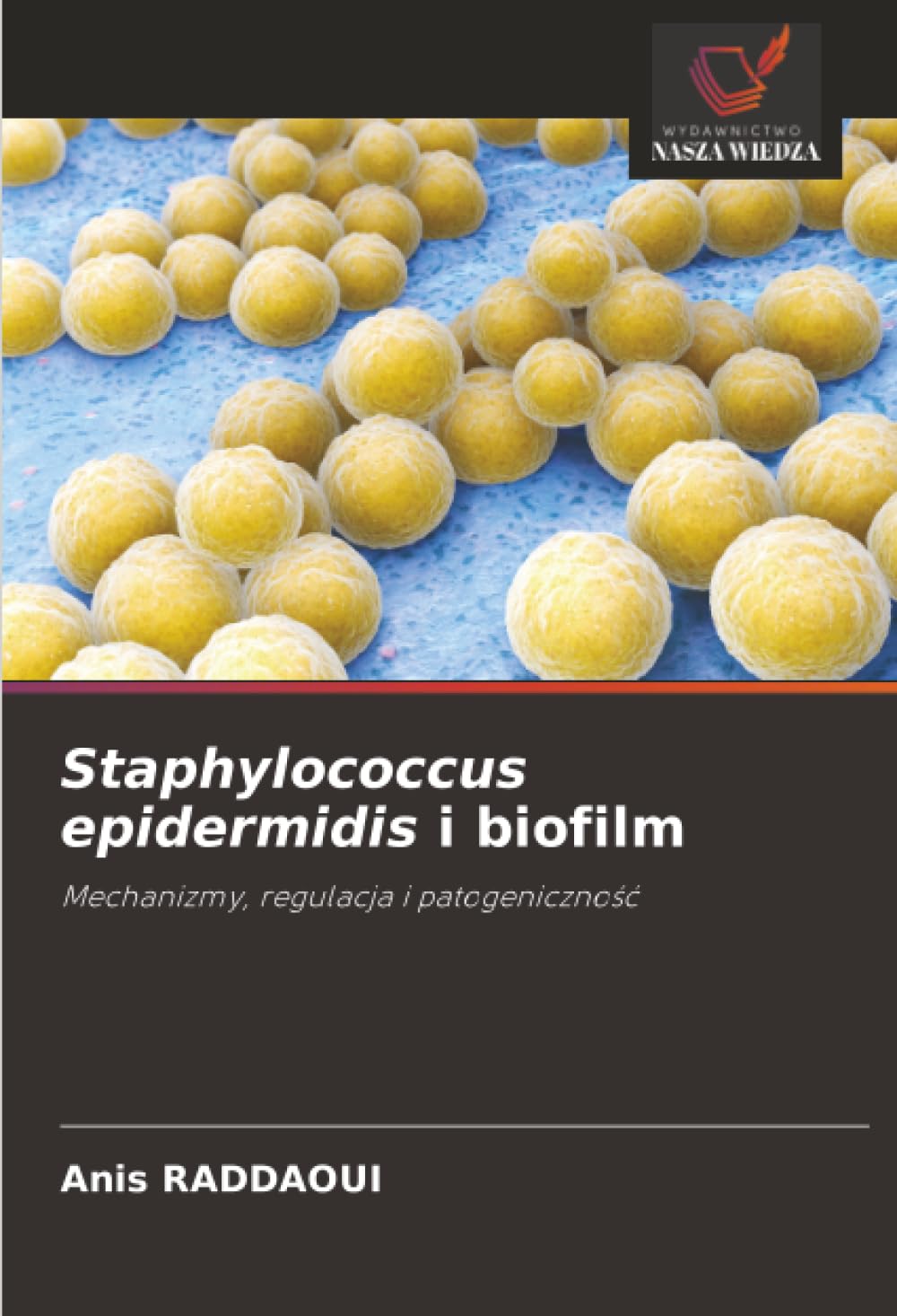 Staphylococcus epidermidis i biofilm: Mechanizmy, regulacja i patogeniczność