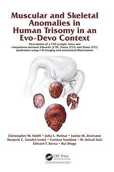 Muscular and Skeletal Anomalies in Human Trisomy in an Evo-Devo Context: Description of a T18 Cyclopic Fetus and Comparison Between Edwards (T18), ... 3-D Imaging and Anatomical Illustrations