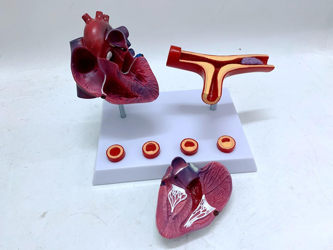 Narzędzia do nauki modelu, nauczanie anatomii serca serca pomostowanie tętnic wieńcowych model z blokadą tętnic i naczyń krwionośnych zakrzepica pomoce dydaktyczne