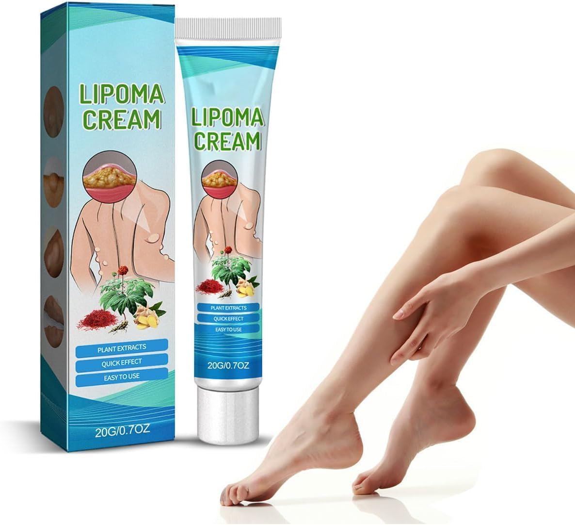 Mazinreem Lipoma Treatment Cream, Herbal Lipoma Removal Cream with Natural Extracts for Soothing and Eliminating Lumps – 20g Ointment for Lipoma Care