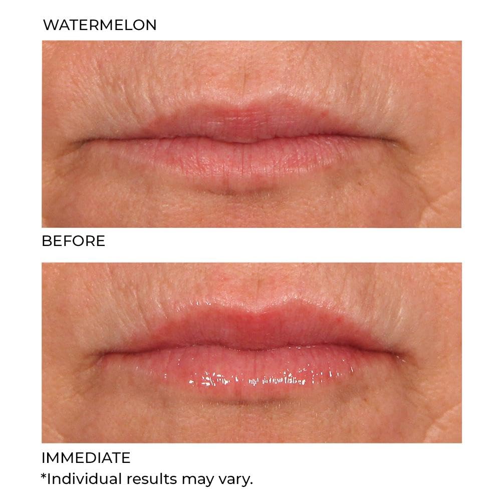 NassifMD Hydro-Screen for Lips