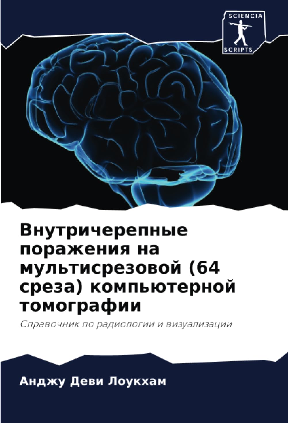 Внутричерепные поражения на мультисрезовой (64 среза) компьютерной томографии: Справочник по радиологии и визуализации: Sprawochnik po radiologii i wizualizacii