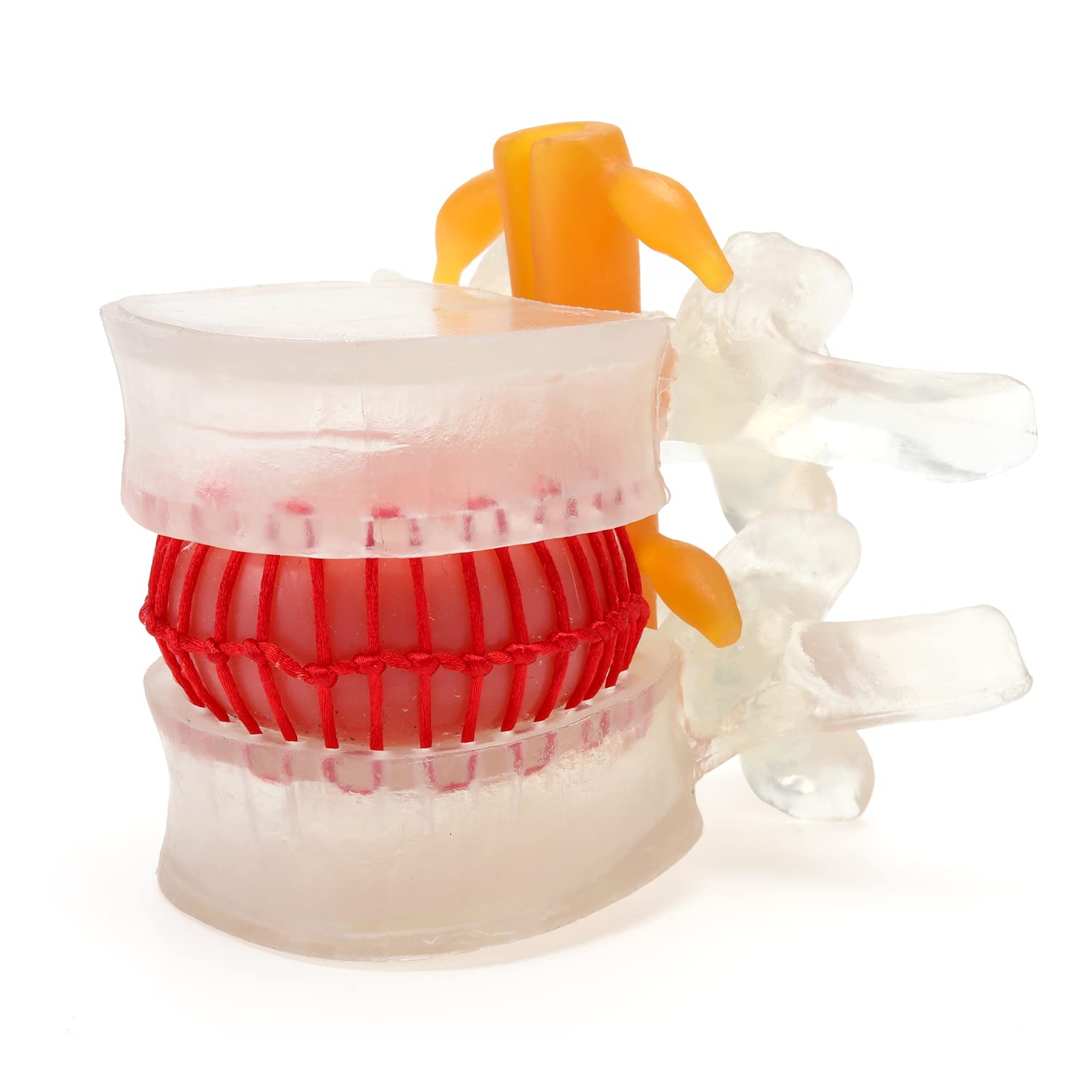 Lumbar Spine Pathology Model, Transparent Lumbar Spine Anatomical Medical Model, Essential Teaching and Learning Tool for Medical